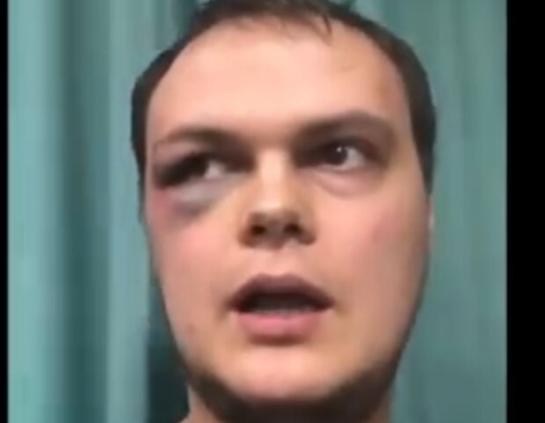 В Харькове активист стал жертвой толпы мажоров, нарушающих карантин, - "Нех*р снимать, мало дали!" В Харькове активист стал жертвой толпы мажоров, нарушающих карантин, - "Нех*р снимать, мало дали!"