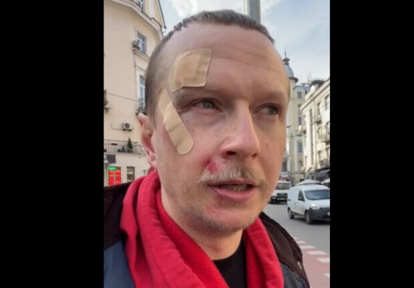 Майкла Щура из "Телебачення Торонто" избили в Киеве: "Они не тормозили" Майкла Щура из "Телебачення Торонто" избили в Киеве: "Они не тормозили"