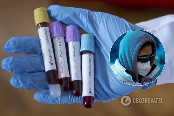
Плюс 455 за сутки! Появилась статистика по коронавирусу в Украине на 1 мая
 