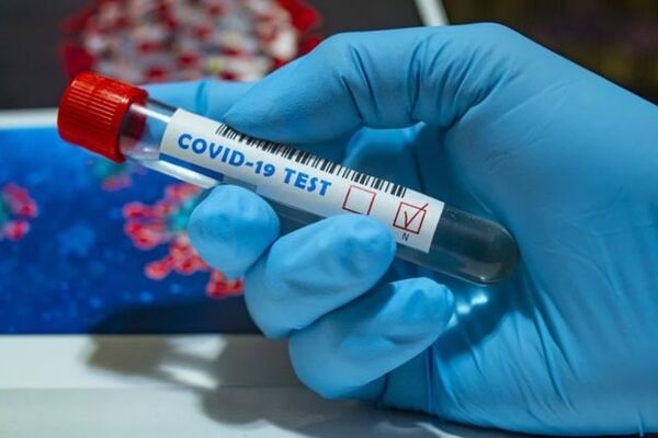 Коронавирус перекинулся на новые страны: статистика по миру и Украине на 27 апреля. Постоянно обновляется
Коронавирус перекинулся на новые страны: статистика по миру и Украине на 27 апреля. Постоянно обновляется