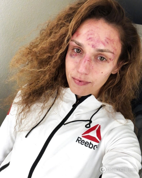 Девушка-боец UFC Антонина Шевченко показала свое лицо после 45 пропущенных ударов
Девушка-боец UFC Антонина Шевченко показала свое лицо после 45 пропущенных ударов