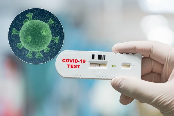 
В Украине установили рекорд тестирования на COVID-19: статистика Минздрава на 21 мая
 