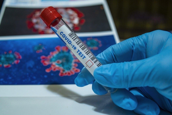 В Турции от Covid-19 вылечились свыше 111 тыс. человек
В Турции от Covid-19 вылечились свыше 111 тыс. человек