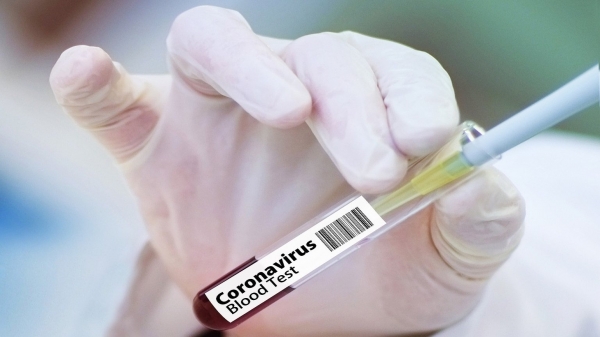 В Украине за сутки выявили 4288 новых случаев заболевания Covid-19
В Украине за сутки выявили 4288 новых случаев заболевания Covid-19